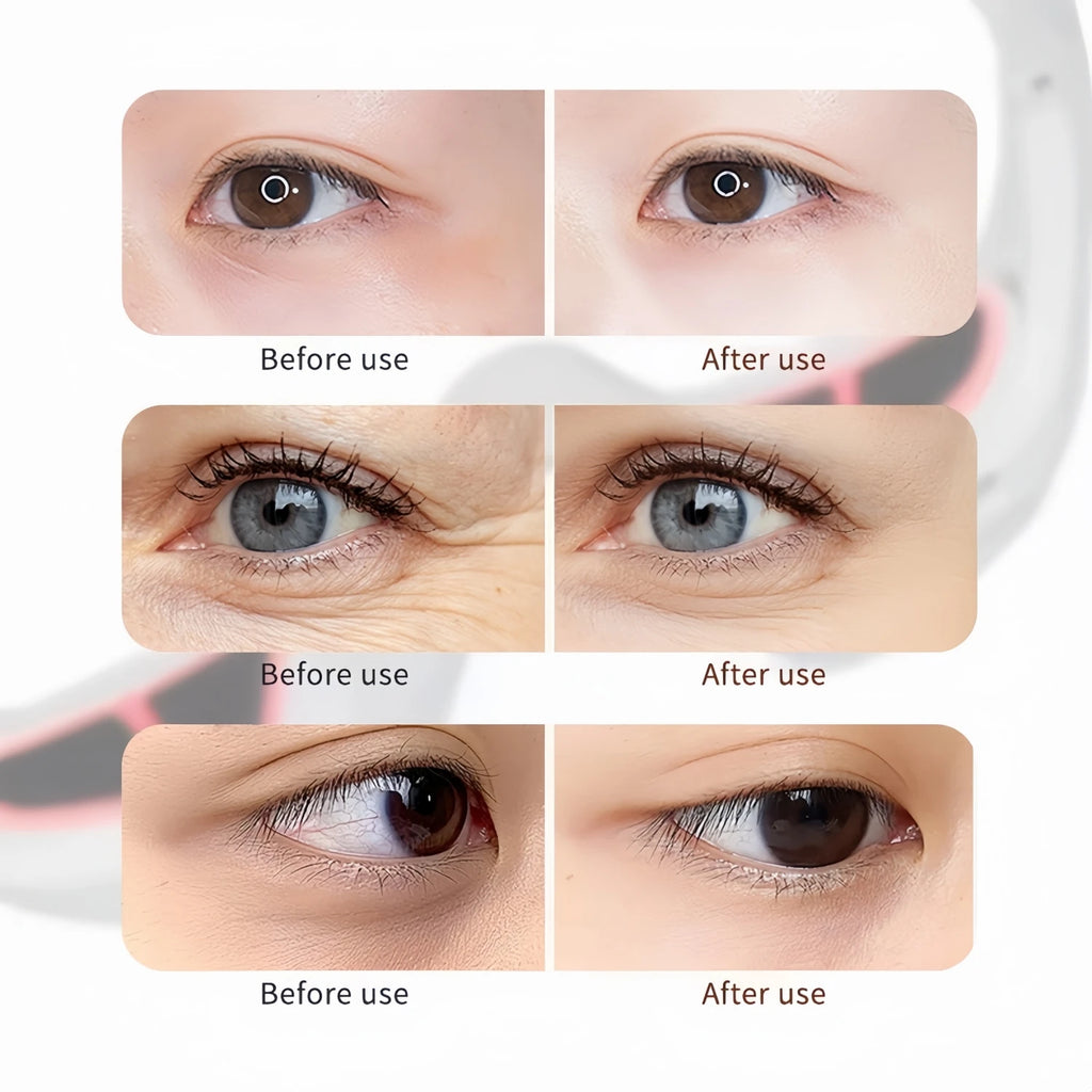 Under Eye Red Light Therapy Device